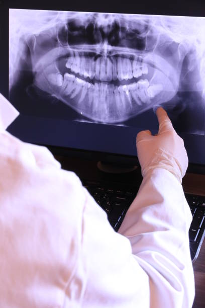 Best Emergency Dentist for Lost Fillings or Crowns in Lansing, MI