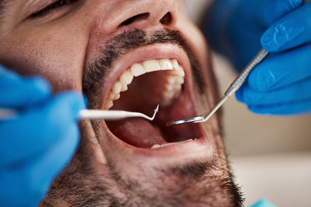 Best Broken or Cracked Tooth Emergency Dentist in Lansing, MI